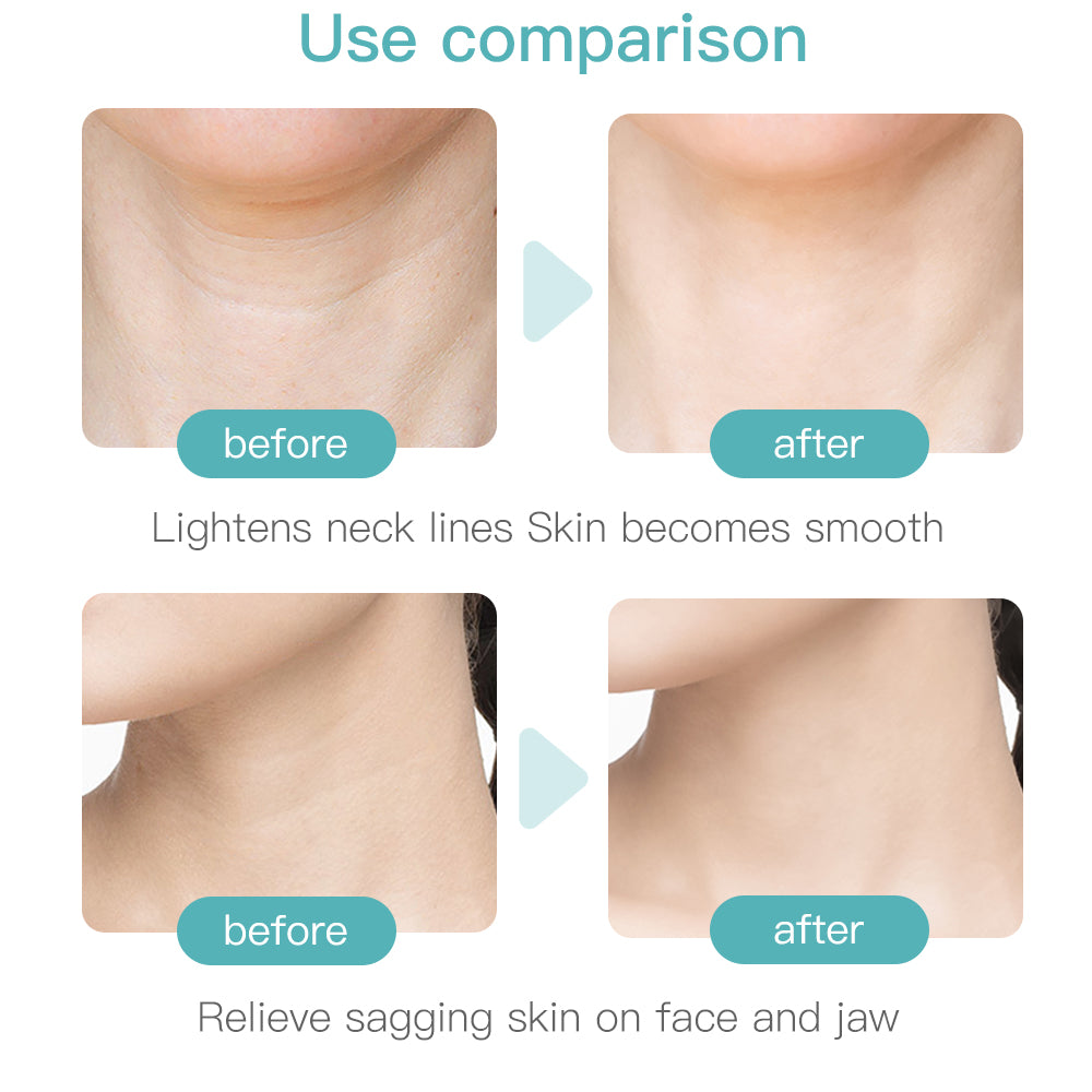 Face and Neck Wrinkle Remover